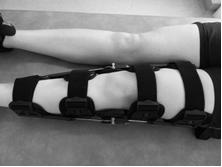 Image of brace properly fitted around leg