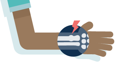 Cartoon image of child's arm showing bones of wrist with red lightening bolt indicating fracture