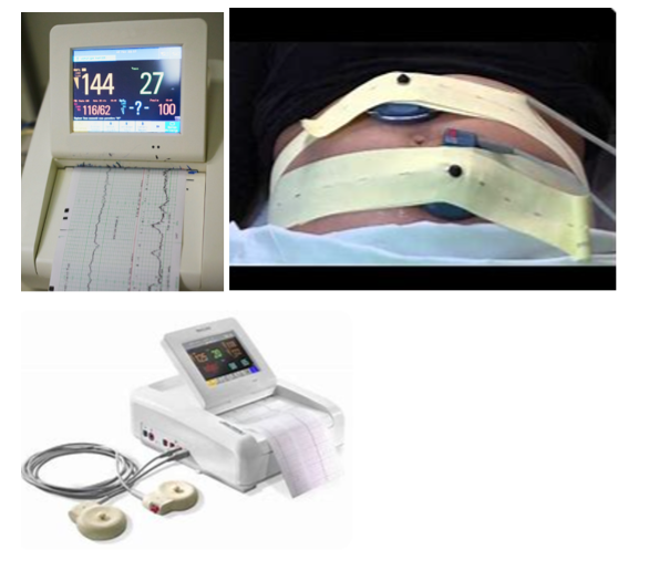 Continuous Electronic Fetal monitoring equipment