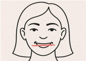 A drawing of a persons face that holds a pencil or similar object between the teeth. 