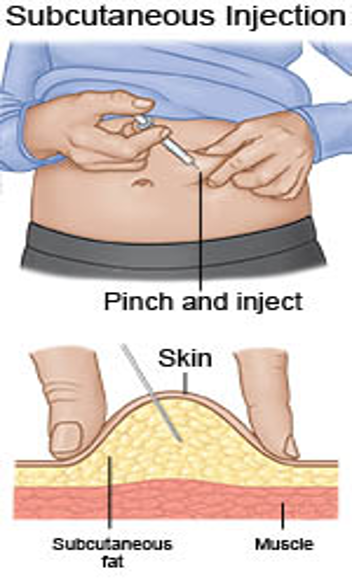 An illustration of how to inject EPO