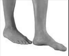 A picture of a person in a standing position with the foot fully in front of the other