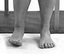 A picture of a persons feet, lifting the outer border, turning it outwards and rolling onto the inner border of the foot